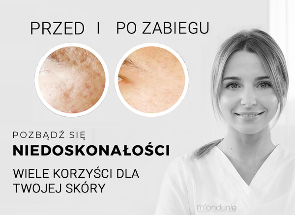 monduniq  poprawa elastyczności oraz jędrności skóry